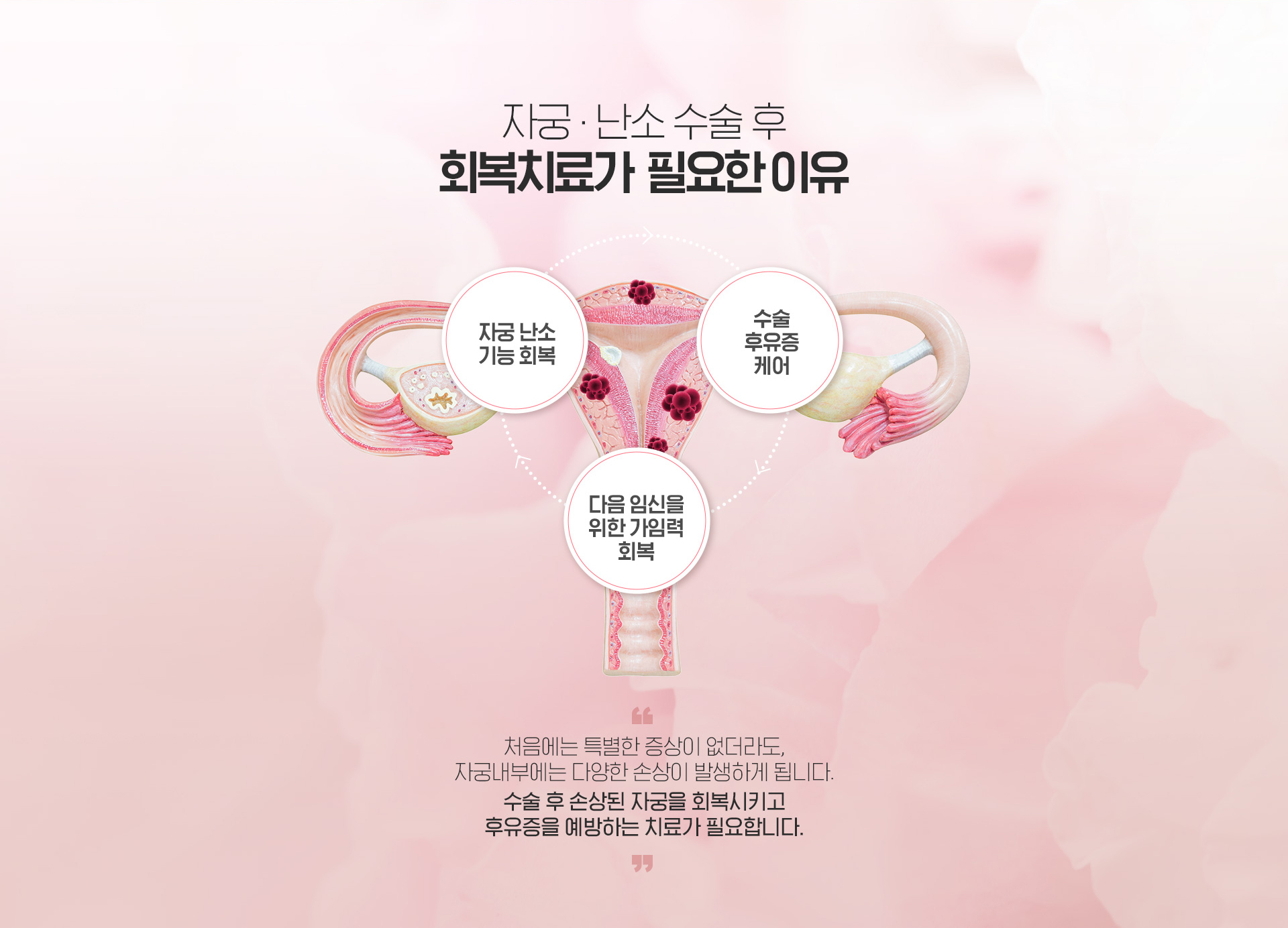 회복치료가 필요한 이유